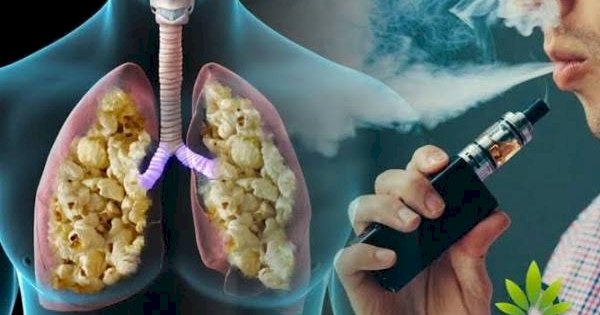 Dianggap Berbahaya Bagi Kesehatan, Pemerintah Diminta Atur Peredaran Vape Liquid