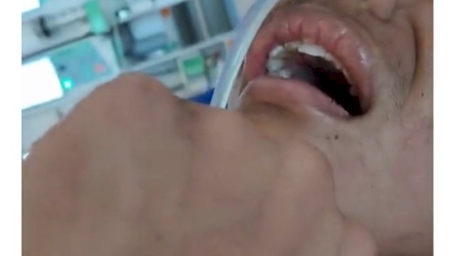 Siuman, David Kepalkan Tangan, Ayah: Aku Tahu Kamu Lagi Marah Tapi Udah Cukup, Istigfar