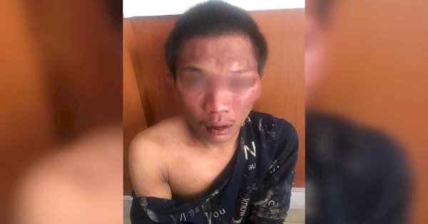 Pemuda Pencuri Motor Babak Belur Diamuk Warga di Jakarta Barat