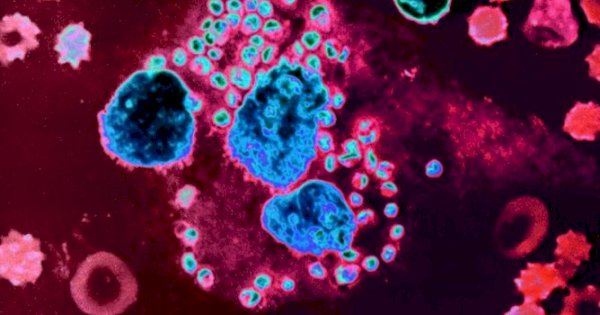 Infeksi Bakteri Langka di Jepang, 293 Orang Meninggal Dunia