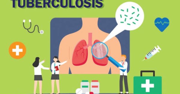 Meningkatkan Temuan Kasus TBC, Dinkes Makassar Aktif Lakukan Skrining Gratis