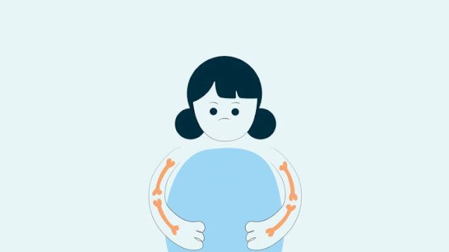 Dampak Kelebihan Berat Badan Terhadap Kesehatan Tulang