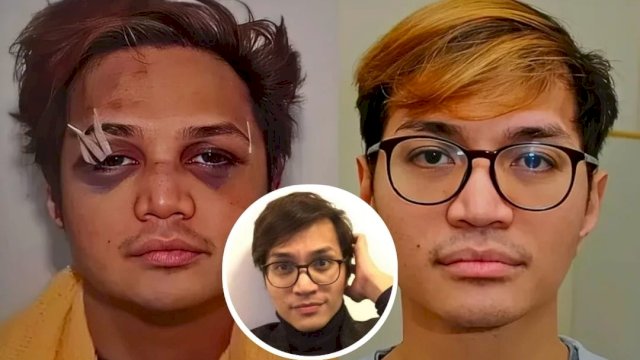 Reynhard Sinaga WNI terpidana seumur hidup atas kasus penyerangan seksual bagi 48 pria Inggris di tahun 2020 silam. Foto: ist