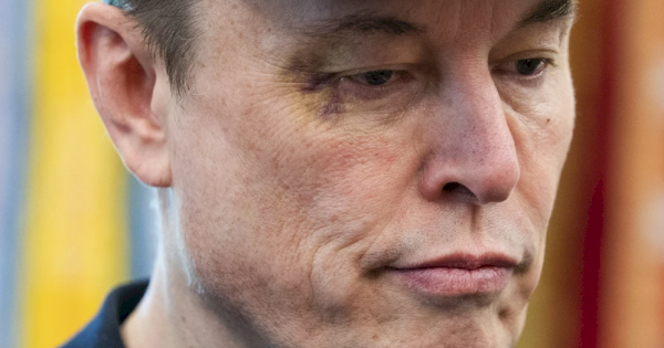 Berpisah dengan Pemerintahan Trump, Mata Elon Musk Lebam