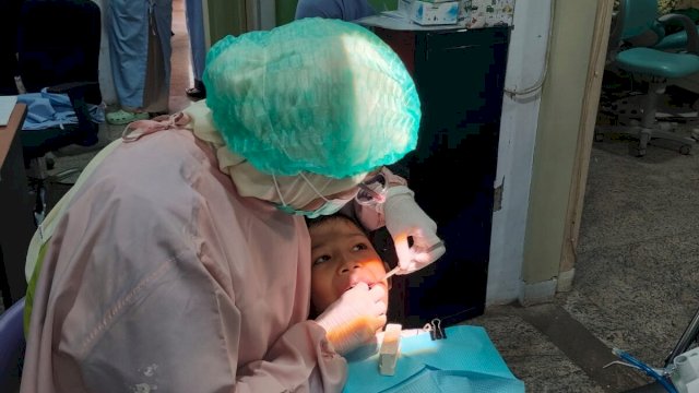 Bahaya karies gigi pada anak. (Foto: ist)