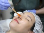 Pendekatan Menyeluruh Miracle Aesthetic Clinic, Tangani Hiperpigmentasi Kulit Pelanggan Indonesia