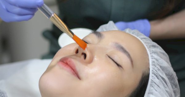 Pendekatan Menyeluruh Miracle Aesthetic Clinic, Tangani Hiperpigmentasi Kulit Pelanggan Indonesia
