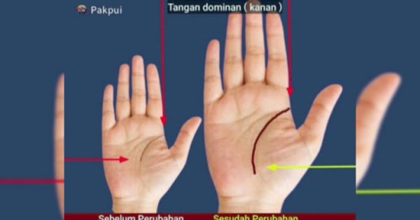 Ilmu Kuno Palmistri: Cara Membaca Nasib Sukses dari Garis Tangan